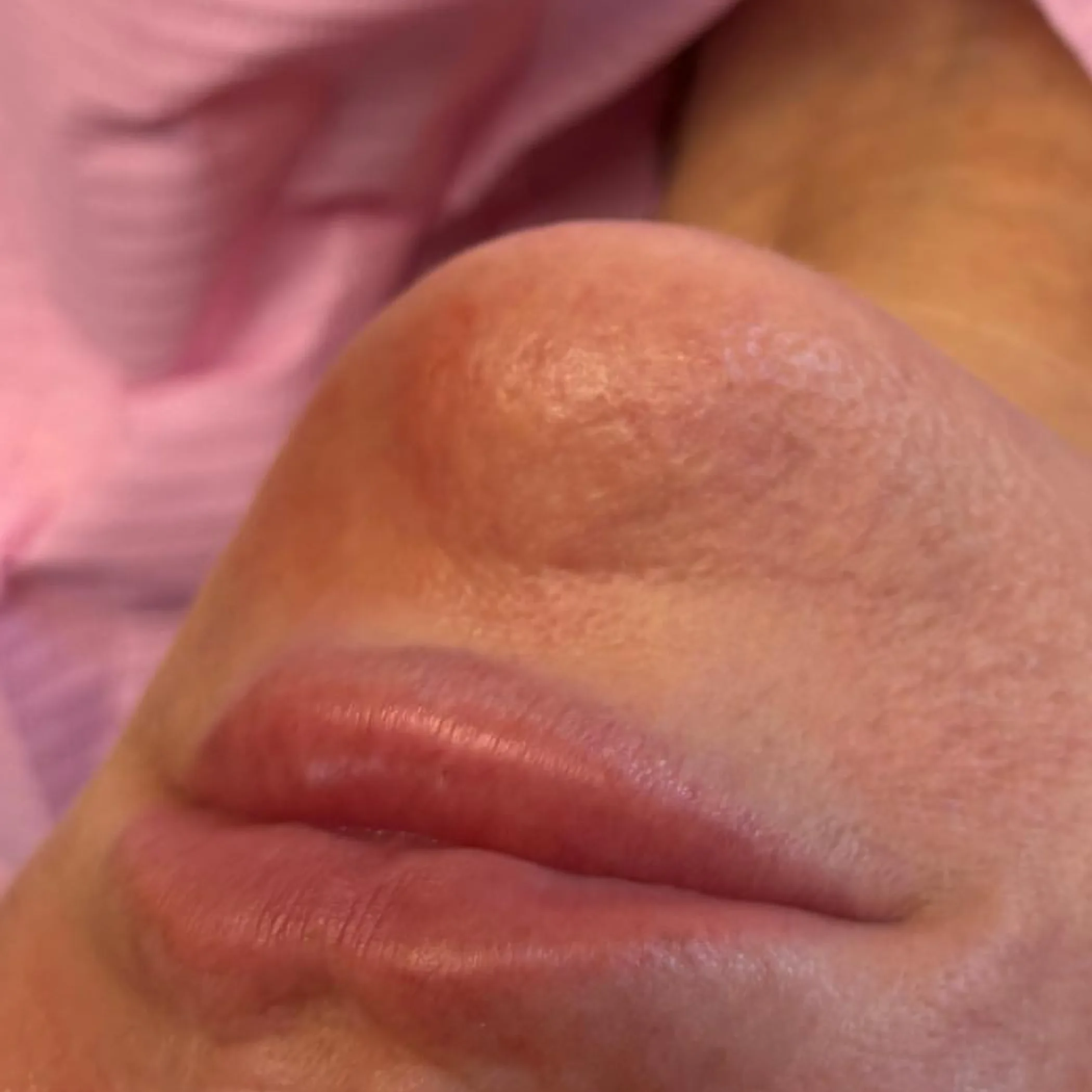 lip tattoo peeling phase natural lighting